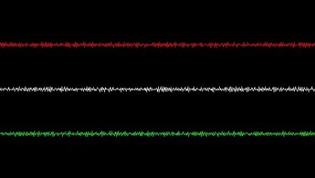 Seismometer